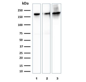 SPTBN2 Antibody / Spectrin beta III