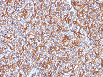 SPTBN2 Antibody / Spectrin beta III