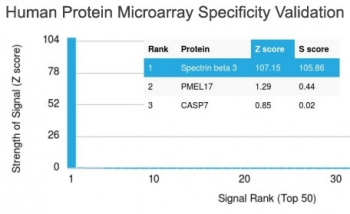 SPTBN2 Antibody / Spectrin beta III