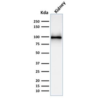 CD10 Antibody / Neprilysin