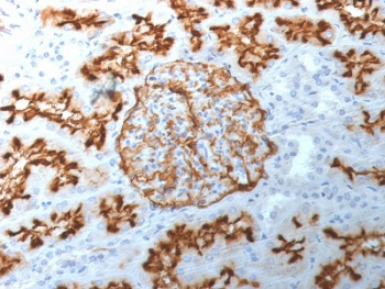 CD10 Antibody / Neprilysin