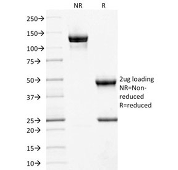 CD10 Antibody / Neprilysin
