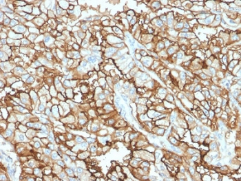 CD10 Antibody / Neprilysin