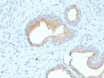 CD10 Antibody / Neprilysin