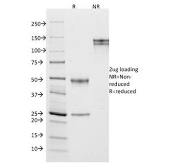 CD10 Antibody / Neprilysin
