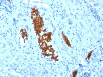 SPTA1 Antibody / Spectrin alpha 1