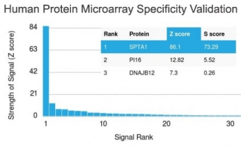 SPTA1 Antibody / Spectrin alpha 1