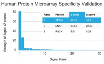 SPTA1 Antibody / Spectrin alpha 1