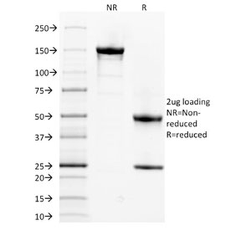 SPTA1 Antibody / Spectrin alpha 1