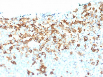 NGF Receptor Antibody / p75NTR / CD271