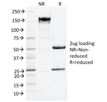 NGF Receptor Antibody / p75NTR / CD271