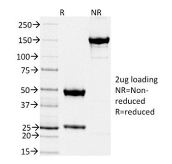 TIMP2 Antibody