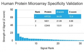 Cytokeratin 20 Antibody / CK20