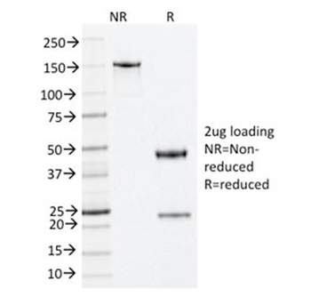 Nucleophosmin Antibody / NPM1