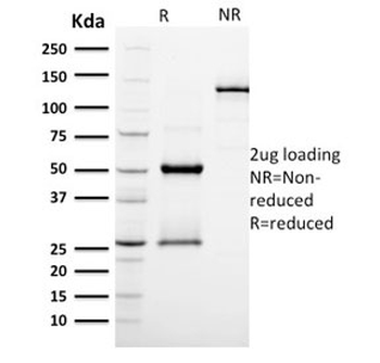 Podocalyxin Antibody / PODXL