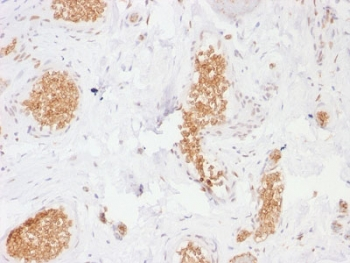 GLUT1 Antibody / SLC2A1