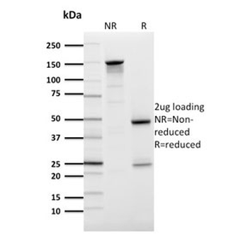 GLUT1 Antibody / SLC2A1