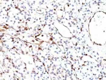 PTEN Antibody