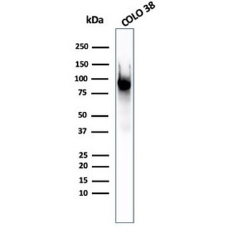 PMEL17 / Melanoma gp100 Antibody