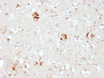 Ubiquitin Antibody
