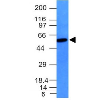 Vimentin Antibody