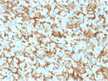 CD163 Antibody