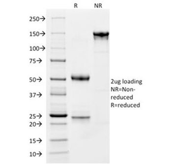 CD163 Antibody