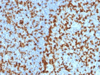 ZAP70 Antibody