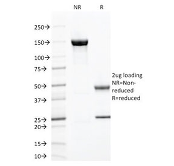 ZAP70 Antibody