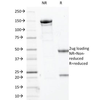 p63 Antibody / Tumor protein 63