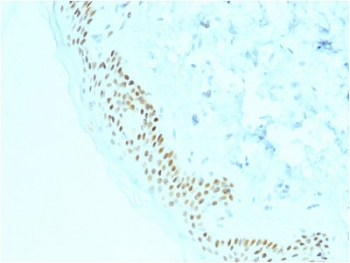 p63 Antibody / Tumor protein 63