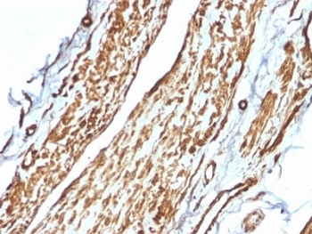Vinculin Antibody