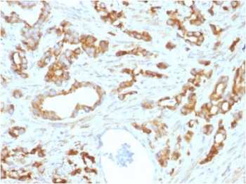 Aurora B Antibody / AURKB
