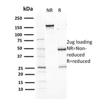 Aurora B Antibody / AURKB
