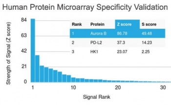 Aurora B Antibody / AURKB