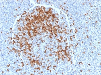 TCL1 Antibody