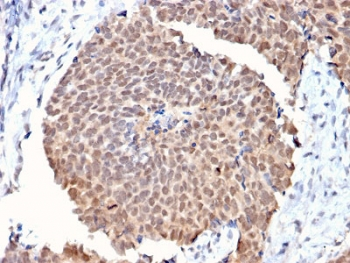 FAF1 Antibody / FAS-associated factor 1