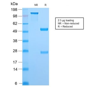 TOP1MT Antibody / Topoisomerase I mitochondrial