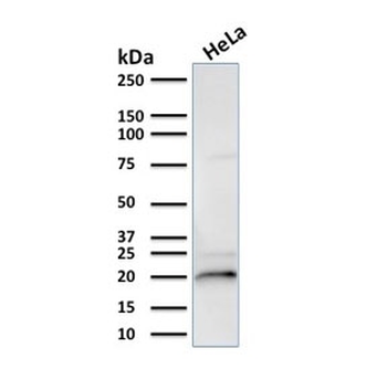 Alpha B Crystallin Antibody / CRYAB