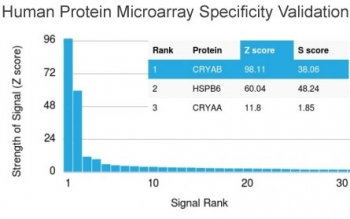 Alpha B Crystallin Antibody / CRYAB