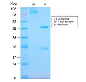 EGF Receptor / EGFR Antibody