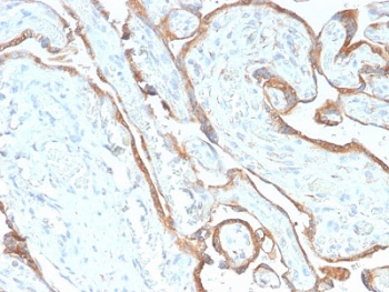 EGF Receptor / EGFR Antibody