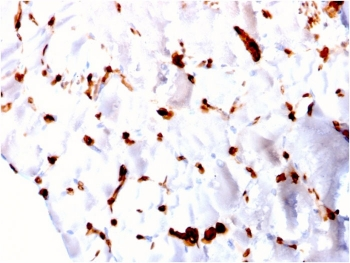 FABP5 Antibody (epidermal)