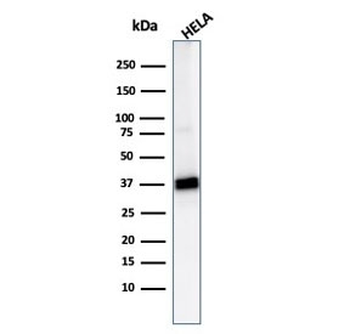 AKR1B1 Antibody / Aldose reductase