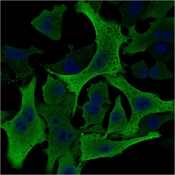 AKR1B1 Antibody / Aldose reductase