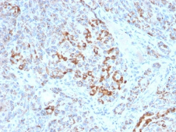 Frataxin Antibody / FXN