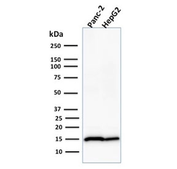 Frataxin Antibody / FXN