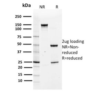 Annexin A1 Antibody
