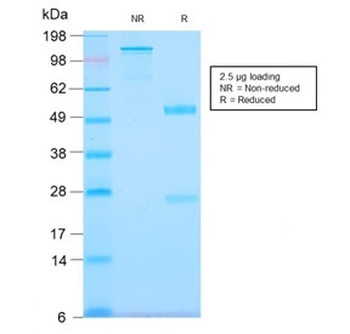Tenascin C Antibody