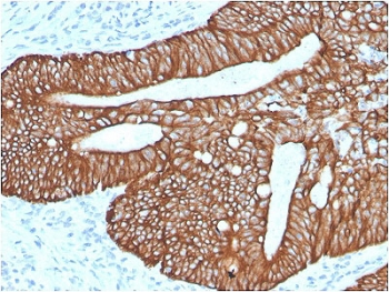 Cytokeratin 18 Antibody